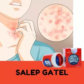 obat gatal di tubuh SALEP SATEL GTL - SALSalep Obat Gatel Gatel Di Seluruh Badan Salep Obat Gatal