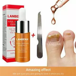 LANBENA jamur kuku nail repair essence oil serum percantik kuku jari tangan dan kaki