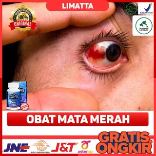 Obat Mata Merah, Obat Mata Iritasi, Obat Mata Pedih, Obat Mata Katarak, Obat Mata Sakit - Limatta