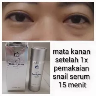 Beautyzen Snail Firming Serum