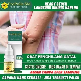 Obat Gatal Pada Kulit, Gatal Seluruh Badan, Gatel Bernanah, Gatal Berair, Bintik Merah, Gatal Di Kemaluan, Selangkangan, Wajah, Tangan, Pantat, Payudara, Kulit Gatal Bentol, Gatal Eksim, Gatal Gatel, Penghilang Gatal Dengan ProPolis SM