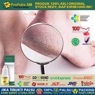 Obat Herbal Kaki Pecah - Pecah & Kapalan Kering, Obat Tetes Oles Kaki Rayapan Bau, Rorombeheun, Obat Telapak Kaki Bolong Bolong Kecil, Tumit Kaki Pecah, Obat Kaki Rinyuhan, Obat Untuk Lubang Kecil Kecil di Telapak Kaki (BPOM RI) Propolis Propolis SM