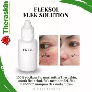 Flek Solution / Fleksol / Melasma Solution