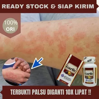 Obat Gatal Alergi, Obat Alergi Pada Tangan, Obat Alergi Dingin, Obat Alergi Kulit Gatal, Obat Alergi Makanan, Obat Penghilang Gatal Jamur, Panu, Kurap Gatal, Obat Kulit Antibakteri, Kadas, Kutu Air, Eksim, Kudis - GARLIC KAPSUL BAWANG PUTIH HITAM Original