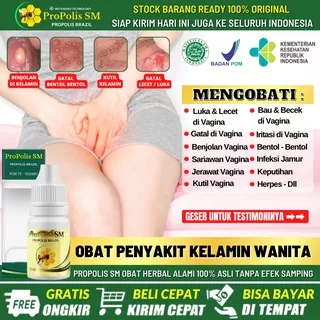 Salep Sariawan di Vagina 100% Alami Tanpa Perih, Obat Oles Alami Vagina Lecet Gatal & Perih, Penghilang Vagina Berbau Tidak Sedap, Obat Bentol Bentol Di Bibir Vagina, Obat Infeksi Jamur di Area Kewanitaan, Atasi Dengan Propolis SM Herbal Alami Asli BPOM