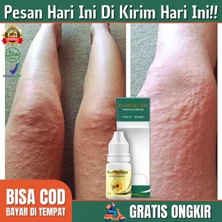 Obat Gatal Kulit - Obat Alergi Gatal Kulit - Obat Gatal Gatal - Obat Alergi - Obat Biduran - Biduran Alergi - Salep Gatal Gatal - Obat Gatal Alergi - Saleb Gatal - Obat Alergi Diterjen - Obat Gatel Alergi - Obat Kaligata - Obat Biduran Kaligata Menahun