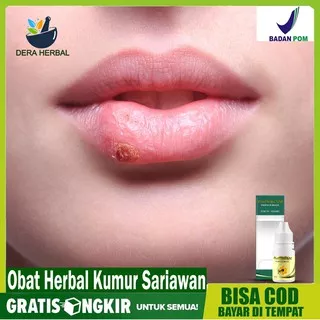 Obat Kumur Sariawan, Obat Tetes Sariawan, Obat Kumur Sakit Gigi Propolis Sm Herbal Gold Bisa COD