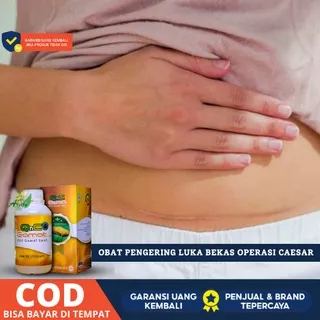 Obat Luka Operasi Caesar, Pengering Luka, Setelah Operasi Caesar, Bekas Operasi Caesar, Pasca Operasi Caesar, QnC Gamat Bukan [SALEP]