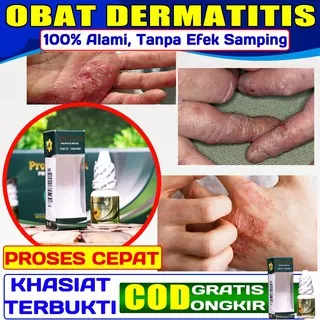 Obat Dermatitis, Kulit Kering / Berair, Perih & Luka, Ruam Kulit Gatal Kering Bersisik - PROPOLIS SM
