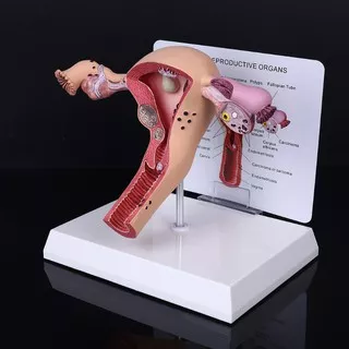 Chua Model Anatomi Uterus Ovary Penyakit Penyakit Penyakit Ovary Untuk Belajar Biologi Lesionus