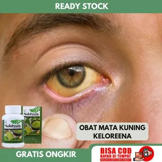 Obat Mata Kuning, Obat Pemutih Mata Kuning, Obat Mata Merah Iritasi dan Berlemak, Obat Penjernih Mata, Obat Mata Minus, Obat Mata Kabur, Obat Mata Berlemak Kekuningan Dengan Herbal Keloreena