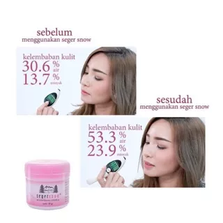 Seger Snow Skin Lightening Cream 35gr