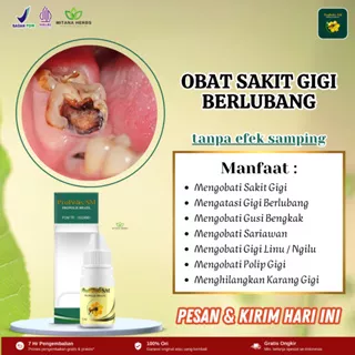 Obat Sakit Gigi Berlubang, Obat Gusi Bengkak, Obat Gigi Ngilu, Obat Bau Mulut, Obat Gigi Berlubang Anak, Obat Gigi Berlubang Dewasa