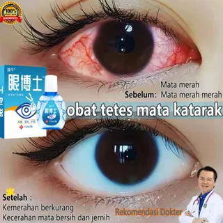 Obat Mata Obat Mata Katarak Obat Tetes Mata 15ml Asli Menyembuhkan Katarak Biolipid Mata kering Sakit mata Darah Merah Ketegangan mata Ma tetes mata softlensta gatal obat