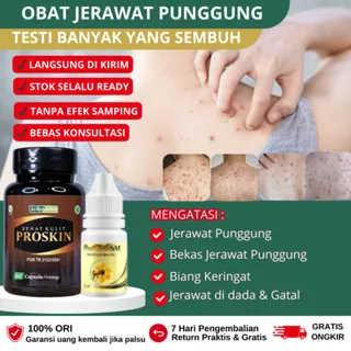 obat gatal punggung, obat jerawat Punggung dan bekas jerawat, salep jerawat punggung, Penghilang jerawat punggung dan bekasnya, Obat bekas jerawat punggung, obat jerawat di punggung, obat jerawat badan punggung , obat jerawat leher dan badan