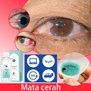 Cairan Steril pencuci mata isi Eye Wash Eye Flush Eye Drops 200ml untuk Iritasi Mata, Mata merah, Mata Kering dan Berair, Bantu Atasi Masalah Kesehatan Mata/ Rabun Jauh/ Mata Merah/ Mata Lelah/Membersihhkan riasan mata dan debu-debu