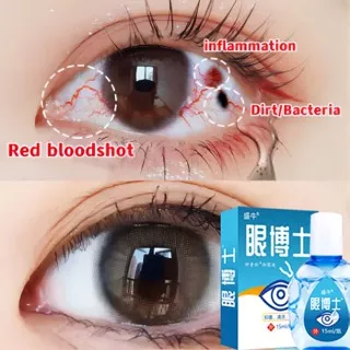 Obat mata obat mata katarak obat tetes mata 15ml Mata kering Sakit mata Darah Merah Ketegangan mata Ma tetes mata softlensta gatal obat
