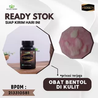 Mitana Herbal - Obat Bentol Kemaluan Pria - Obat Bentol Buah Zakar - Obat Bentol Selangkangan - Obat Bentol Mr P - Obat Bentol Di Kelamin - Obat Bentol Bentol Gatal