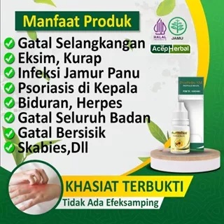 Obat Gatal Kulit Salep Kulit Gatal Eksim Exim Psoriasis Kepala Borok Infeksi Jamur Kurap Alergi Dingin Biduran Anak skabies Slangkangan Scabies Selangkangan Paha Alergi Seluruh Badan Herpes Koreng Gatel Bersisik Menahun Propolis SM Herbal Tetes Oles Gatal