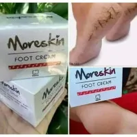 Obat kaki pecah pecah - Obat kaki rayapan - Cream kaki pecah pecah