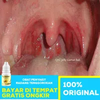 Propolis SM Brazil - Obat Radang Tenggorokan, Obat Tenggorokan Sakit