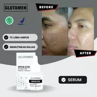 Glutamen Skincare Serum Pemutih Wajah Kusam Glowing Pria BPOM