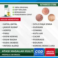 Obat Herpes Dompo/Zoster, Cacar Api/Ular, Herbal Propolis SM Asli