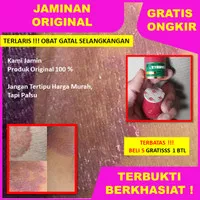 Salep Gatal Di Buah Zakar Obat Gatal Herbal Original |Salep BL