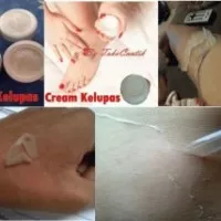 CREAM KELUPAS ORIGINAL