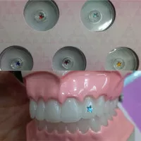 diamond gigi bentuk bintang permata gigi berlian gigi gem teeth